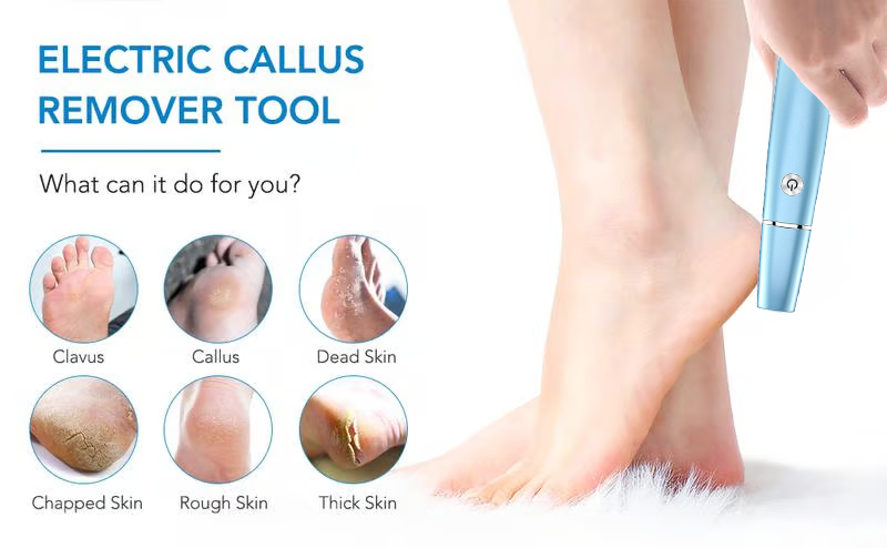 š„Hot Sale - 50% OFFš„Electric Feet Callus Removerā”